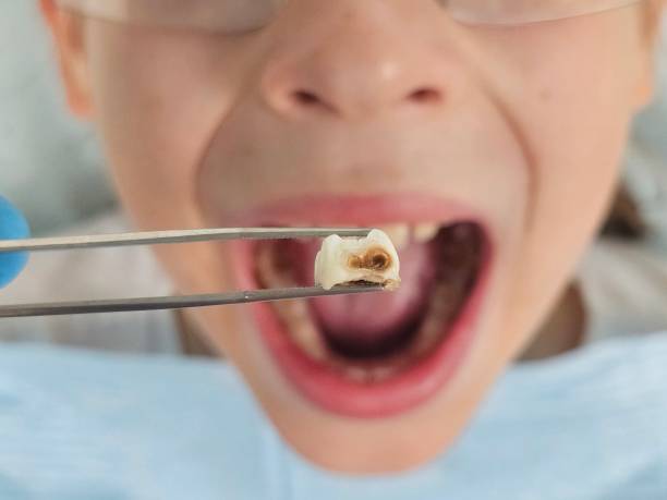 Best Pediatric Emergency Dentist in Blacksburg, SC